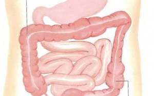 Táo bón mãn tính dễ gây ung thư ruột già