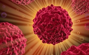 Iran: Dùng cảm biến nano chẩn đoán sớm ung thư