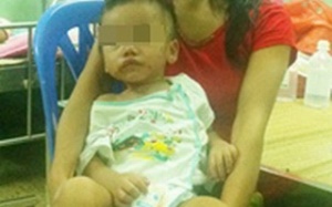 Cứu sống bé trai 2 tuổi bị thủng đại tràng