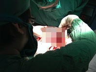 'Tự sướng' quái chiêu - mang họa