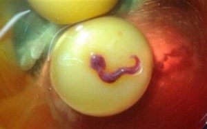 Sự thật vụ sinh vật lạ trong lòng đỏ trứng gà