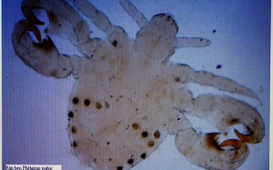 Xuất hiện nhiều trường hợp rận mu kí sinh