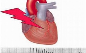 Phòng tránh biến chứng khi người cao tuổi bị sốt