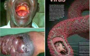 Virus Ebola ‘giết người’ như thế nào?