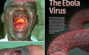 Phát hiện liều thuốc trị virus Ebola?