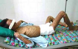 16 tỉnh gia tăng số người nhiễm HIV