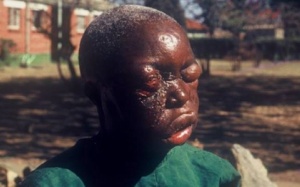 Những hình ảnh rùng rợn từ tâm dịch Ebola