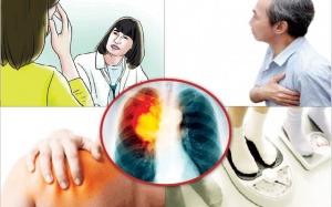 Ung thư phổi: 10 dấu hiệu cảnh báo