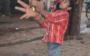 Kỳ lạ: Cậu bé có đôi tay nặng... 16kg