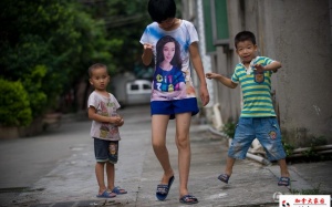 Kỳ lạ người phụ nữ có hai bộ phận sinh dục