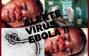 Những câu hỏi thường gặp về dịch bệnh do virus Ebola