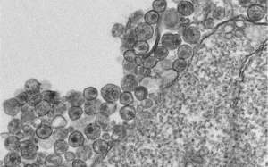 Phát hiện khả năng ngăn chặn HIV, Ebola phát tán