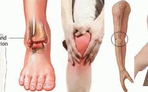 Những cơn đau lúc nửa đêm…