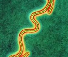 Ebola: Thử nghiệm vaccine trên người ở Mỹ