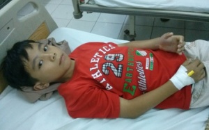 Bệnh nhi bị rắn lục cắn khi đang ngủ