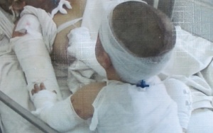 Ca mổ bụng mẹ bị bỏng cứu con ở Đăk Nông được hỗ trợ 200 triệu đồng