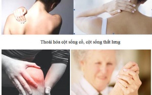 Đau nhức xương khớp - Bệnh thường gặp của người già