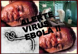 2.461 người đã chết vì Ebola