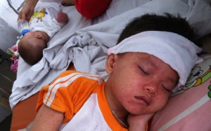 Những câu hỏi thường gặp về bệnh sởi