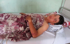 Cứu sống bệnh nhân vỡ bàng quang, xương chậu