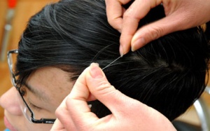 Làm gì khi tóc bạc sớm