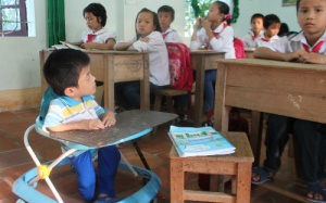 Nghị lực phi thường của cậu bé xương thủy tinh