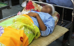 Cứu sống bệnh nhân bị 2 thanh sắt xuyên não