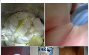 Sữa Physiolac gây dị ứng: Những kết luận lập lờ cho nghi án