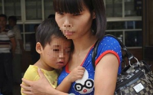 Bé gái 29 tháng bị hàng xóm bạo hành man rợ