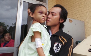 Bé 4 tuổi bị bố mẹ bạo hành đã  được xuất viện