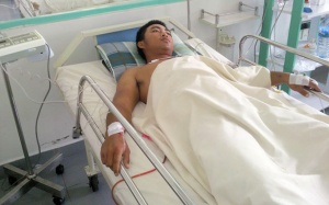 Cứu sống bệnh nhân bị tai nạn lao động nặng