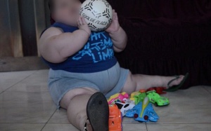 Mắc bệnh lạ cậu bé 3 tuổi nặng tới 70 kg