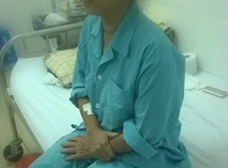 Cắt thùy trên phổi bằng phương pháp nội soi