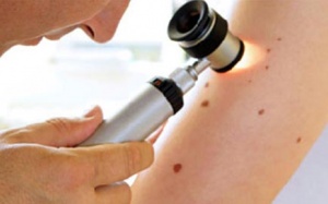 Ung thư da: Khó nhận biết nhưng nguy hiểm