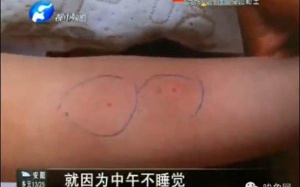 Chọc kim vào người trẻ vì không ngủ trưa