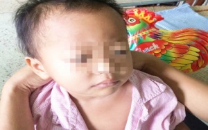 Cảnh giác khi trẻ đau bụng bất thường