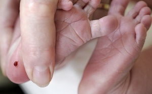 Sàng lọc sơ sinh phát hiện sớm bệnh nan y