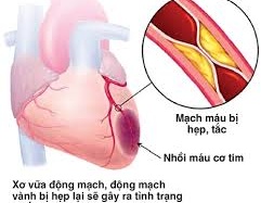 Phòng suy mạch vành tái phát bằng cách nào?
