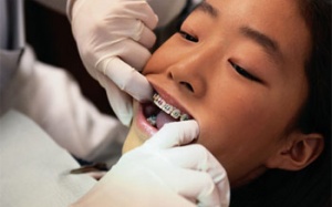 Cấp cứu trẻ 12 tuổi nuốt dây kẽm niềng răng