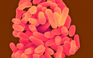 WHO: Báo động sự gia tăng của lao đa kháng thuốc