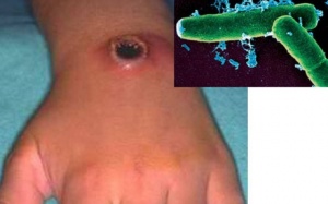 Đức lo ngại nguy cơ thịt bò nhiễm bệnh than 