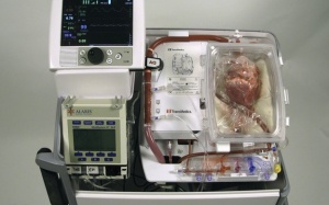 Tim ngừng đập 20 phút vẫn cấy ghép được