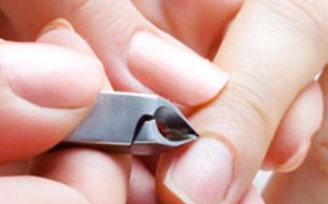 Nhiễm HIV sau khi làm móng