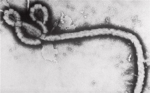 Ebola lây qua đường tình dục?