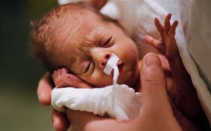 Lưu ý dinh dưỡng khi chăm sóc trẻ sinh non