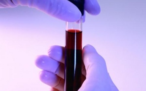 Liệu pháp gene hiệu quả trong điều trị bệnh máu khó đông