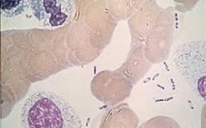 WHO cảnh báo nguy cơ tái bùng phát dịch hạch