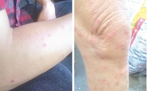 Côn trùng lạ tấn công người dân