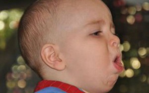 Trẻ bị ho: Những cách trị dứt điểm