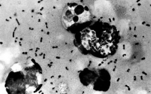 Kháng sinh thông thường có thể chữa khỏi dịch hạch